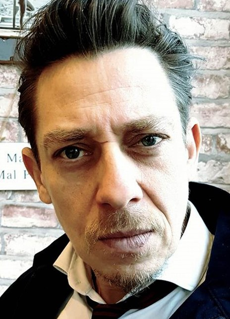 米尔顿·威尔士 Milton Welsh